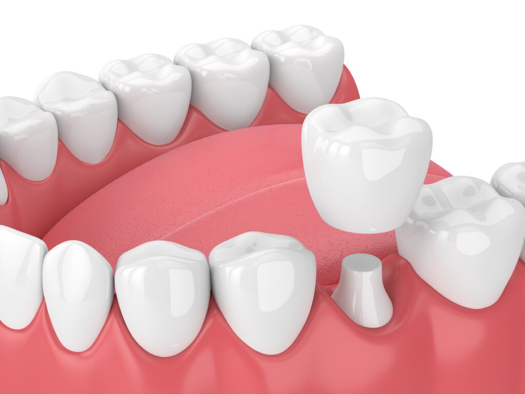 - Meridian Dental Care