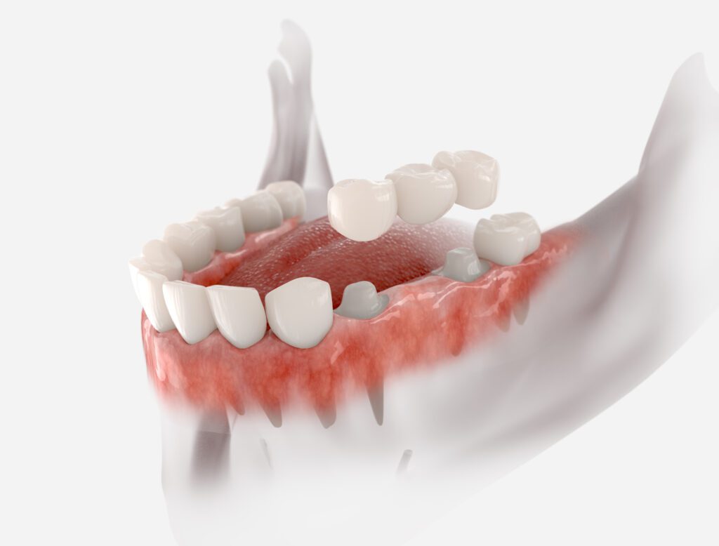 - Meridian Dental Care