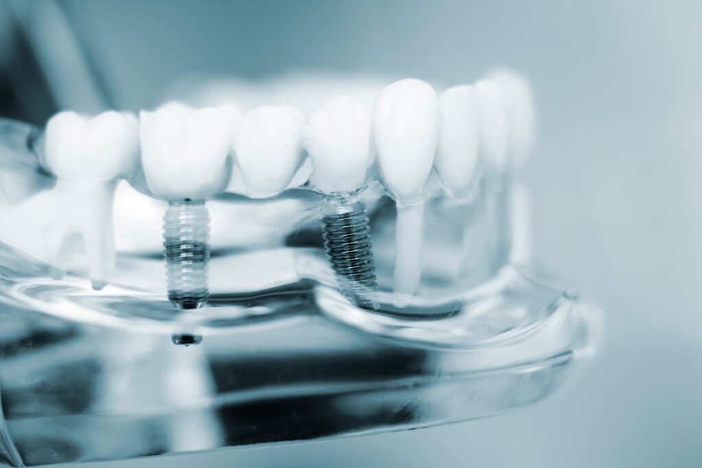- Meridian Dental Care