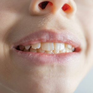 - Meridian Dental Care