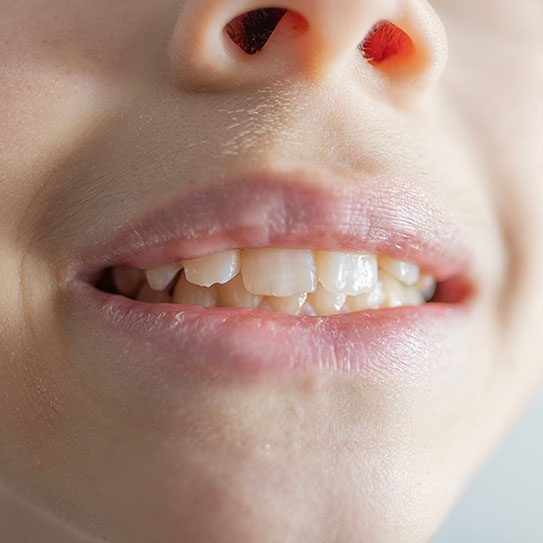 - Meridian Dental Care