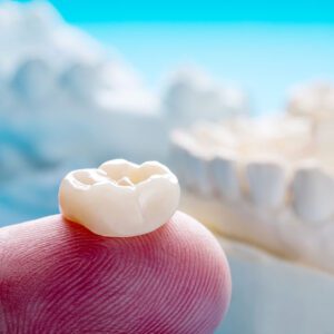 dentist Puyallup WA same-day crowns