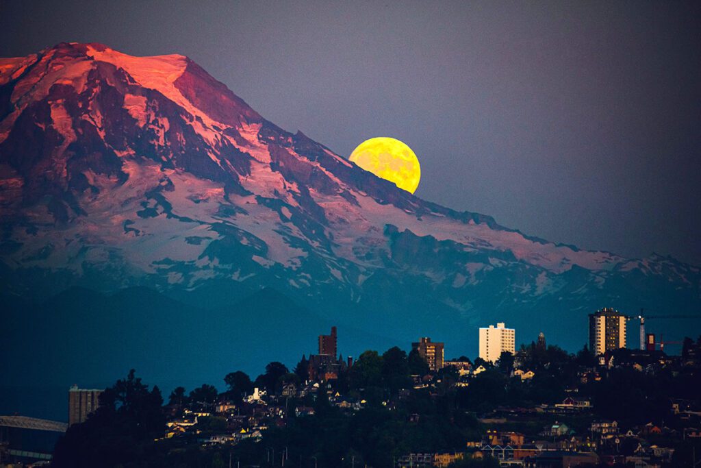 dentist Tacoma
